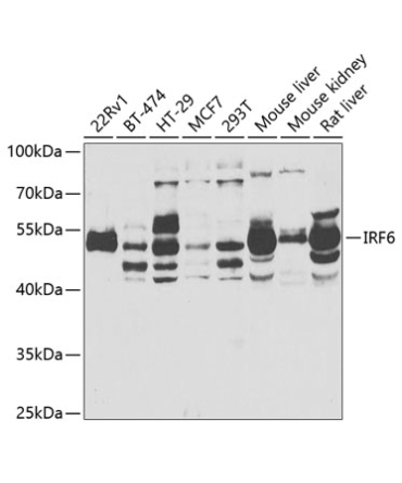 IRF6 Rabbit Polyclonal Antibody