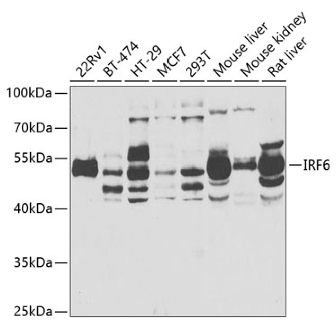 IRF6 Rabbit Polyclonal Antibody