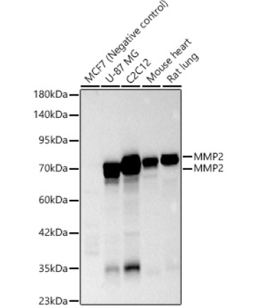MMP2 Rabbit Polyclonal Antibody