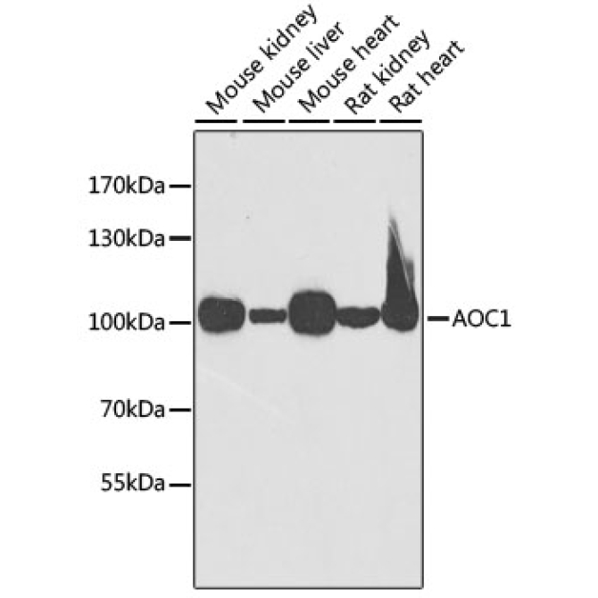 AOC1 Rabbit Polyclonal Antibody