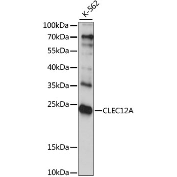 CLEC12A Rabbit Polyclonal Antibody