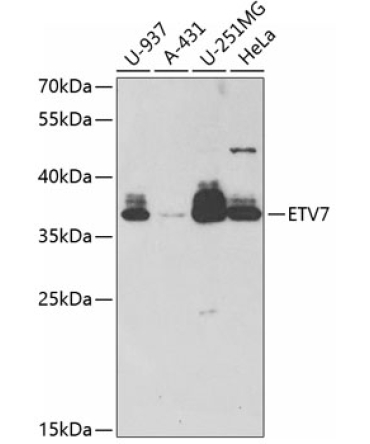 ETV7 Rabbit Polyclonal Antibody