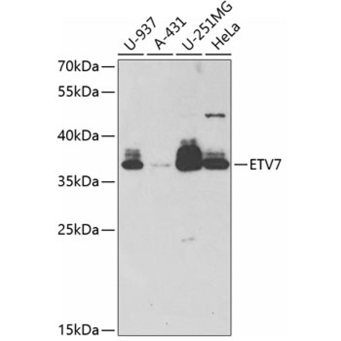 ETV7 Rabbit Polyclonal Antibody