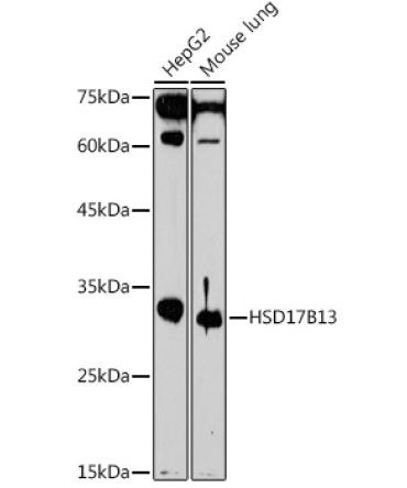 HSD17B13 Rabbit Polyclonal Antibody