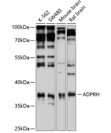 ADPRH Rabbit Polyclonal Antibody