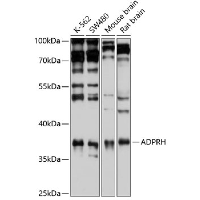 ADPRH Rabbit Polyclonal Antibody