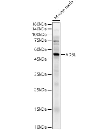 ADSL Rabbit Polyclonal Antibody