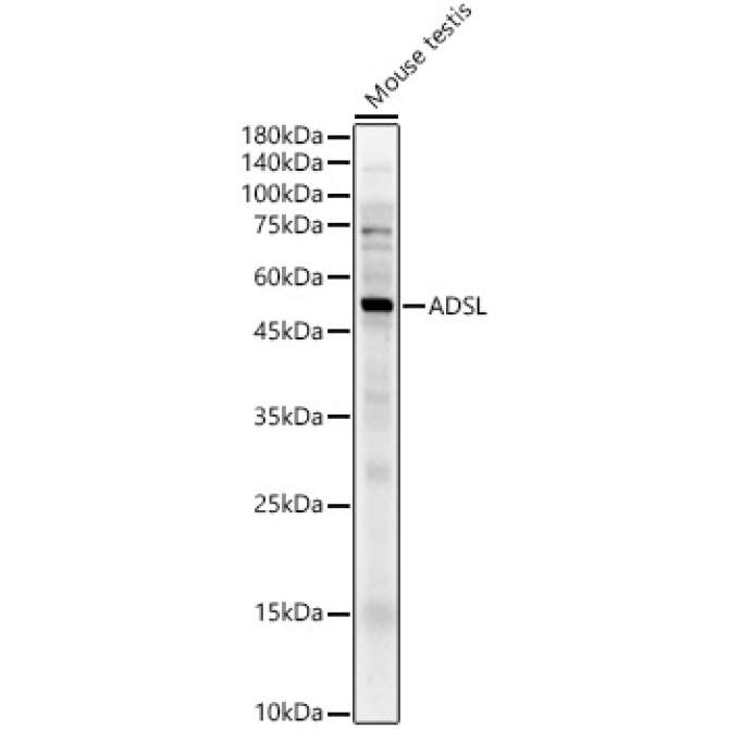 ADSL Rabbit Polyclonal Antibody