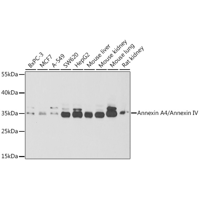 Annexin A4/Annexin IV Rabbit Polyclonal Antibody