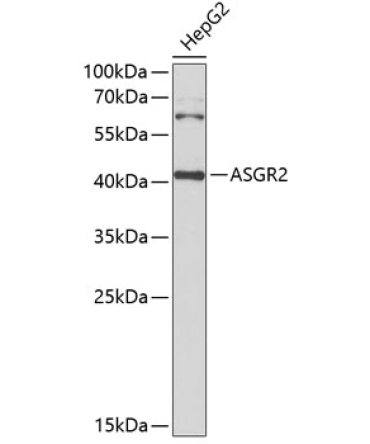ASGR2 Rabbit Polyclonal Antibody
