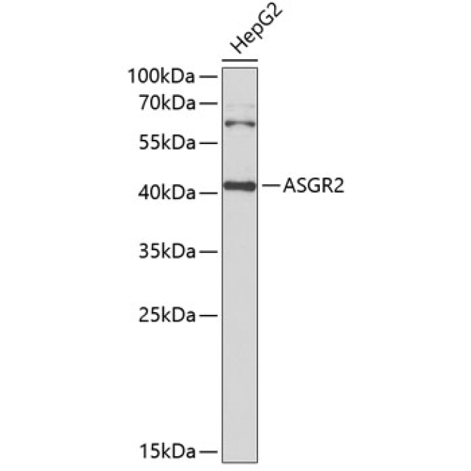 ASGR2 Rabbit Polyclonal Antibody