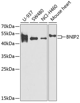 BNIP2 Rabbit Polyclonal Antibody