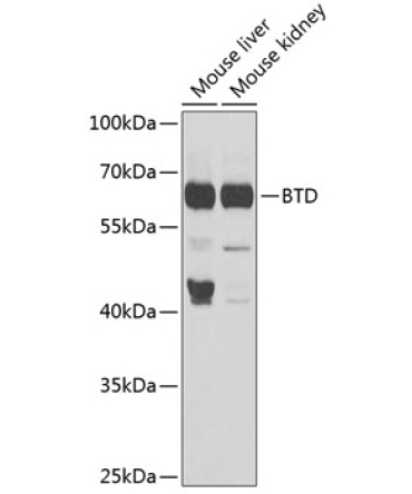 BTD Rabbit Polyclonal Antibody