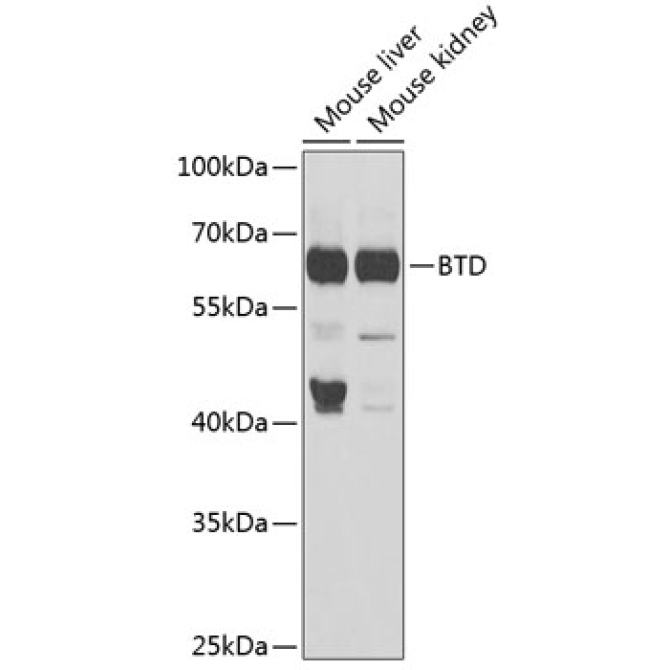 BTD Rabbit Polyclonal Antibody