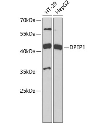 DPEP1 Rabbit Polyclonal Antibody