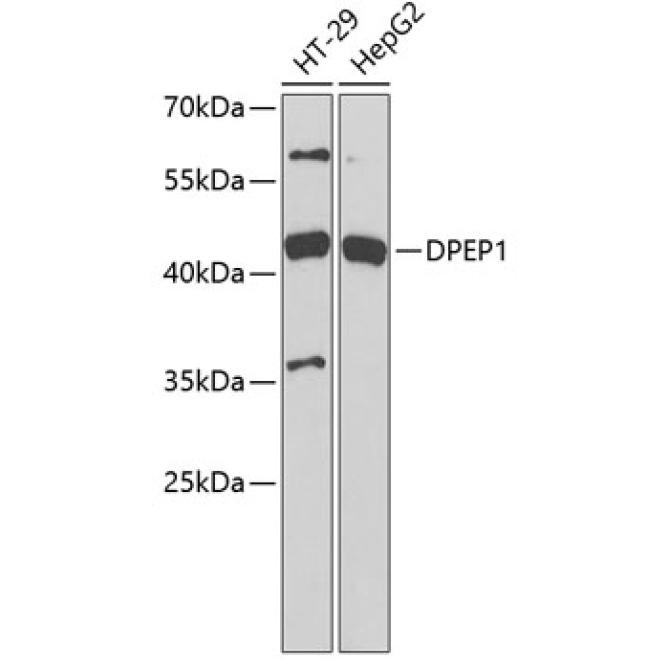DPEP1 Rabbit Polyclonal Antibody