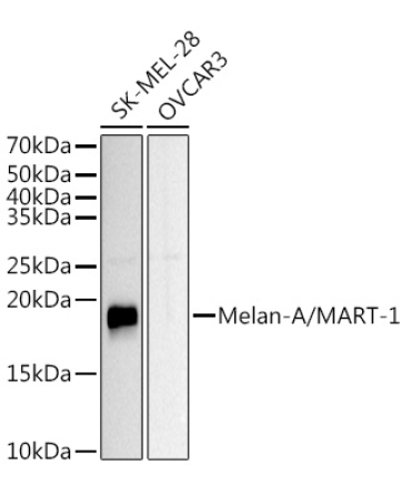 Melan-A/MART-1 Rabbit Polyclonal Antibody