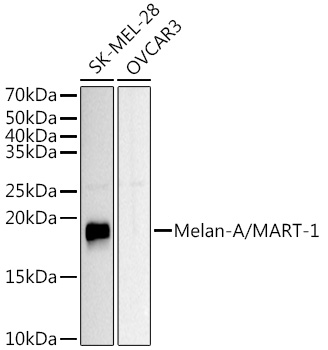 Melan-A/MART-1 Rabbit Polyclonal Antibody