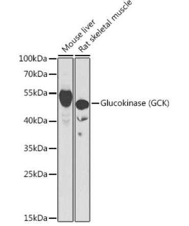 Glucokinase (GCK) Rabbit Polyclonal Antibody