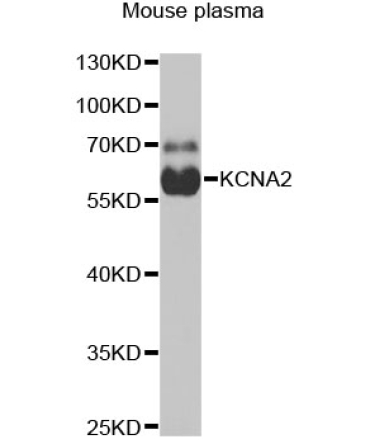 KCNA2 Rabbit Polyclonal Antibody