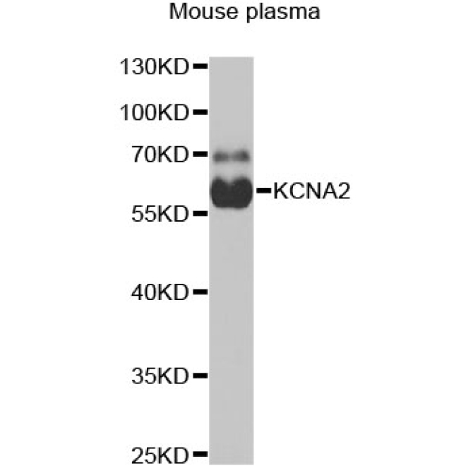 KCNA2 Rabbit Polyclonal Antibody