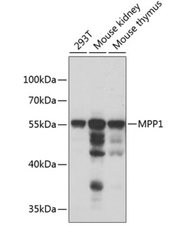 MPP1 Rabbit Polyclonal Antibody