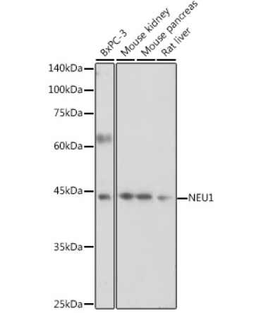 NEU1 Rabbit Polyclonal Antibody
