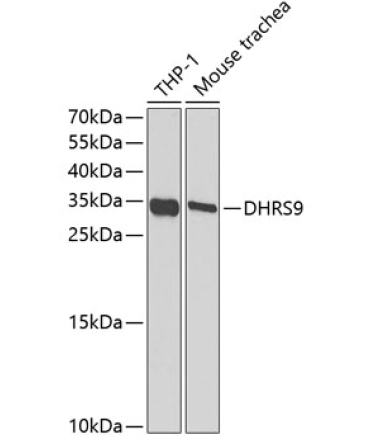 DHRS9 Rabbit Polyclonal Antibody