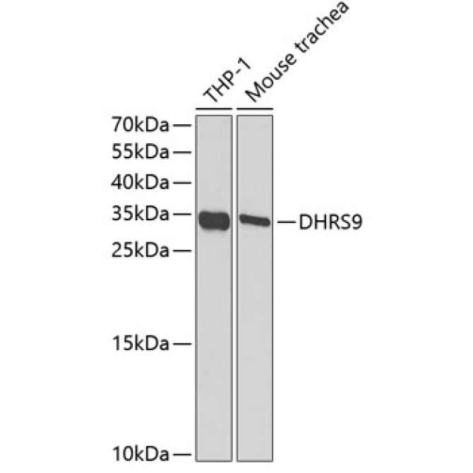 DHRS9 Rabbit Polyclonal Antibody