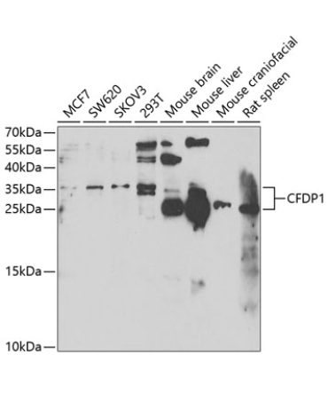 CFDP1 Rabbit Polyclonal Antibody
