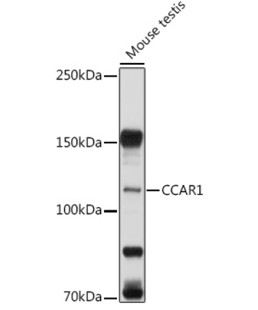 CCAR1 Rabbit Polyclonal Antibody