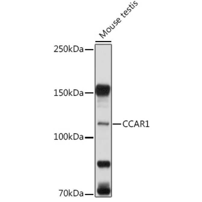 CCAR1 Rabbit Polyclonal Antibody
