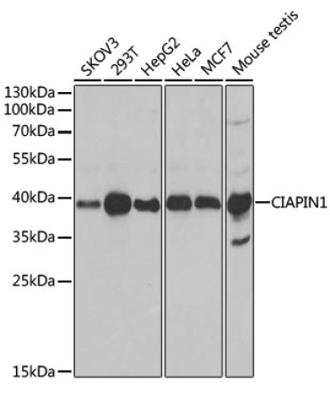 CIAPIN1 Rabbit Polyclonal Antibody