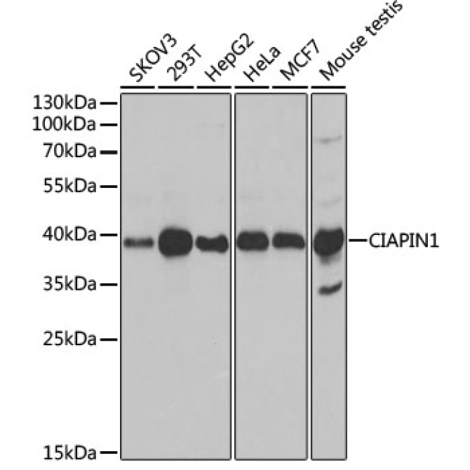CIAPIN1 Rabbit Polyclonal Antibody