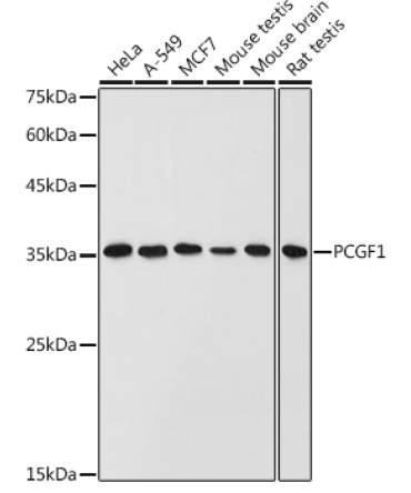 PCGF1 Rabbit Polyclonal Antibody