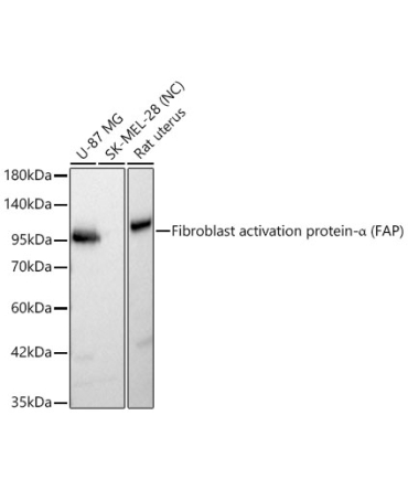 Fibroblast activation protein-Alpha (FAP) Rabbit Polyclonal Antibody