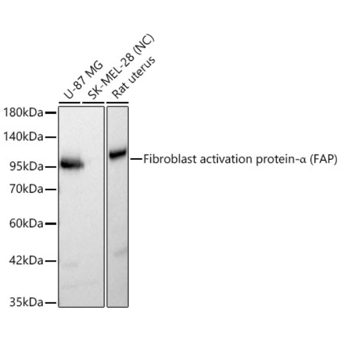Fibroblast activation protein-Alpha (FAP) Rabbit Polyclonal Antibody