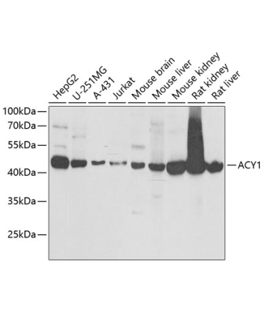 ACY1 Rabbit Polyclonal Antibody