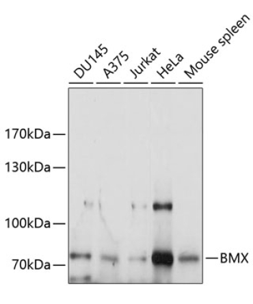 BMX Rabbit Polyclonal Antibody