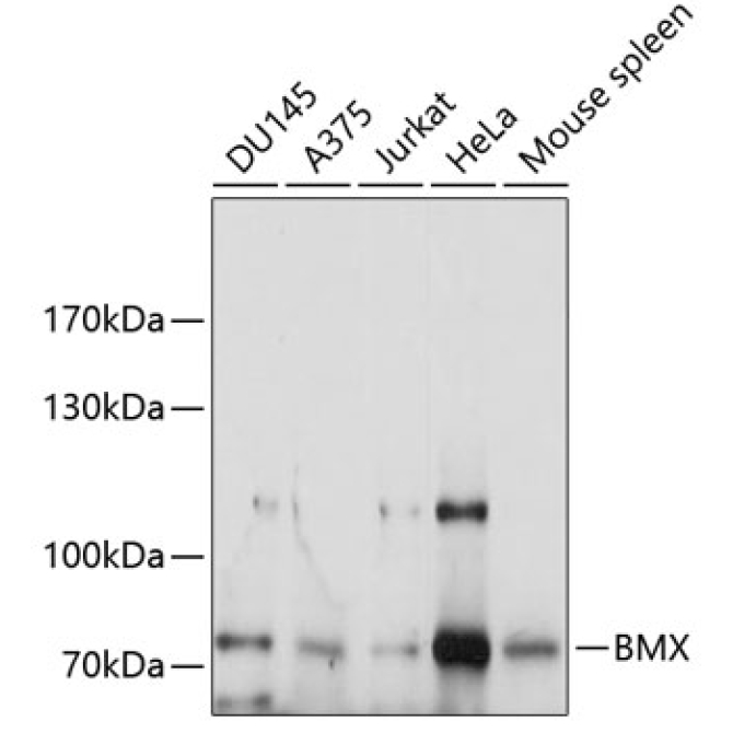 BMX Rabbit Polyclonal Antibody