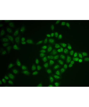 BTG1 Rabbit Polyclonal Antibody