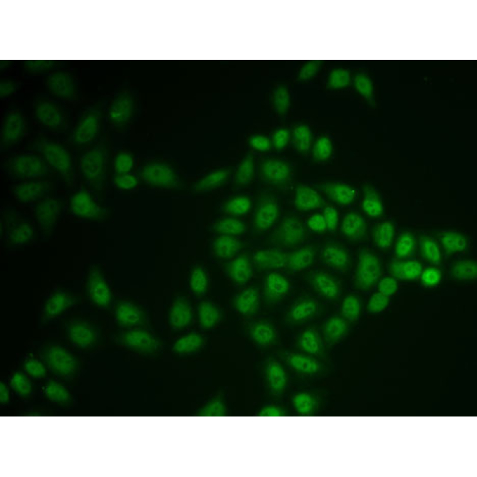 BTG1 Rabbit Polyclonal Antibody