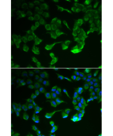C1R Rabbit Polyclonal Antibody