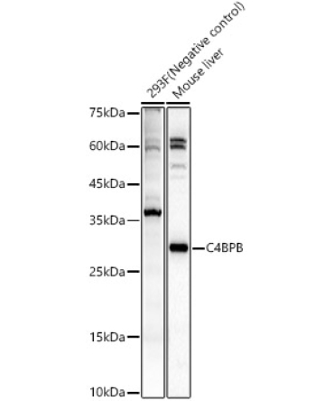 C4BPB Rabbit Polyclonal Antibody