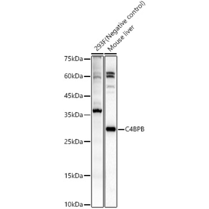 C4BPB Rabbit Polyclonal Antibody