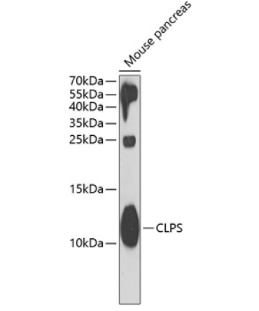 CLPS Rabbit Polyclonal Antibody