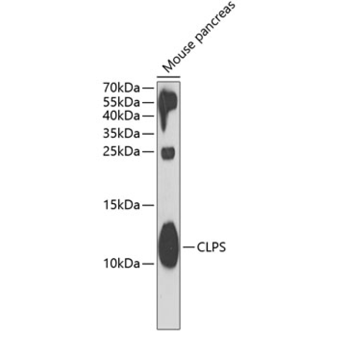 CLPS Rabbit Polyclonal Antibody