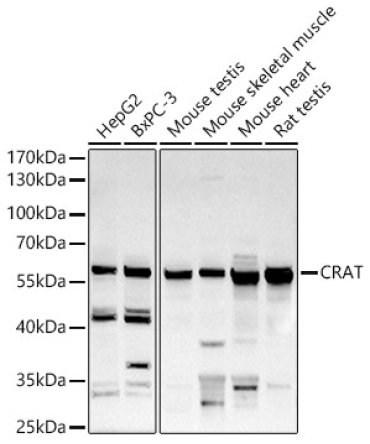 CRAT Rabbit Polyclonal Antibody