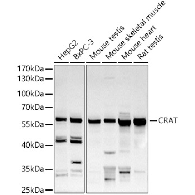 CRAT Rabbit Polyclonal Antibody
