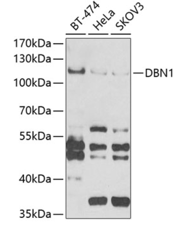 DBN1 Rabbit Polyclonal Antibody